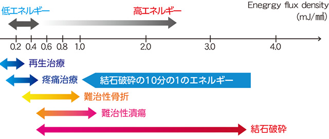 Q1. 衝撃波とは何ですか？